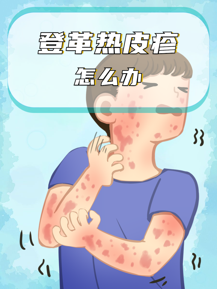 登革热的死亡率高吗?