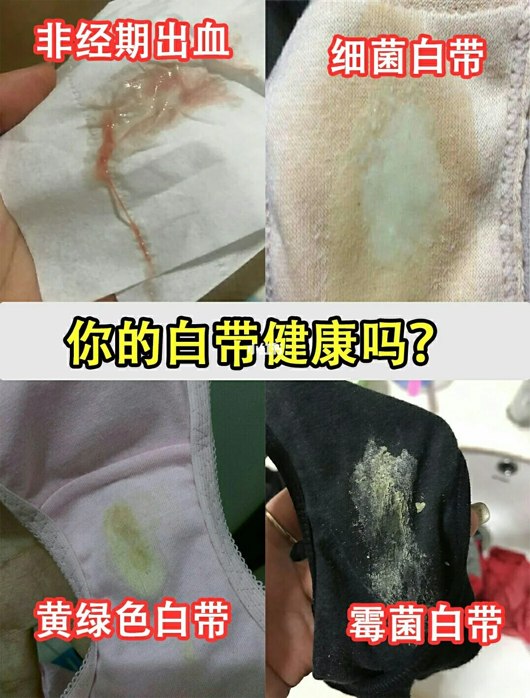 正常的白带是什么样的