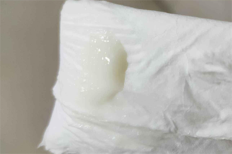 正常的白带是什么样的