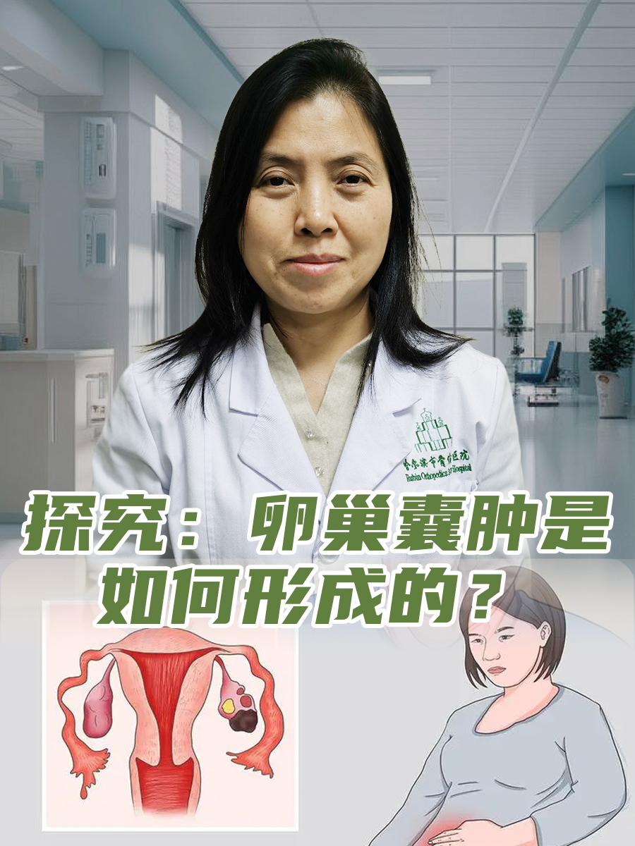 卵巢囊肿会自己消失吗?