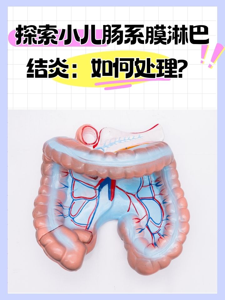 肠系膜淋巴结炎是什么病