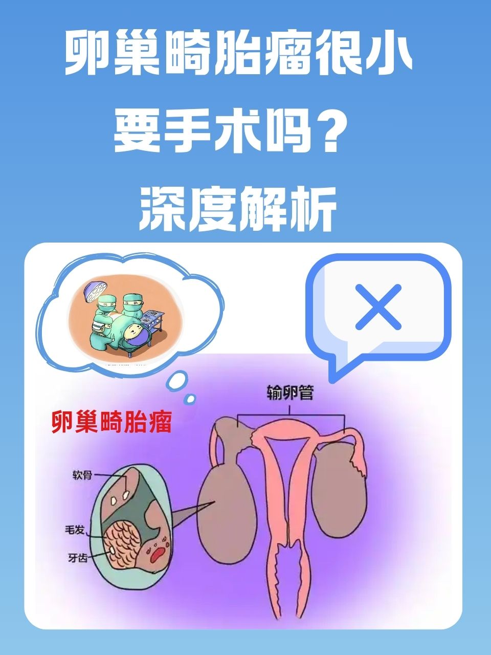 畸胎瘤是由什么原因引起的?