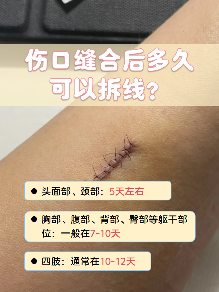 手术几天可以拆线