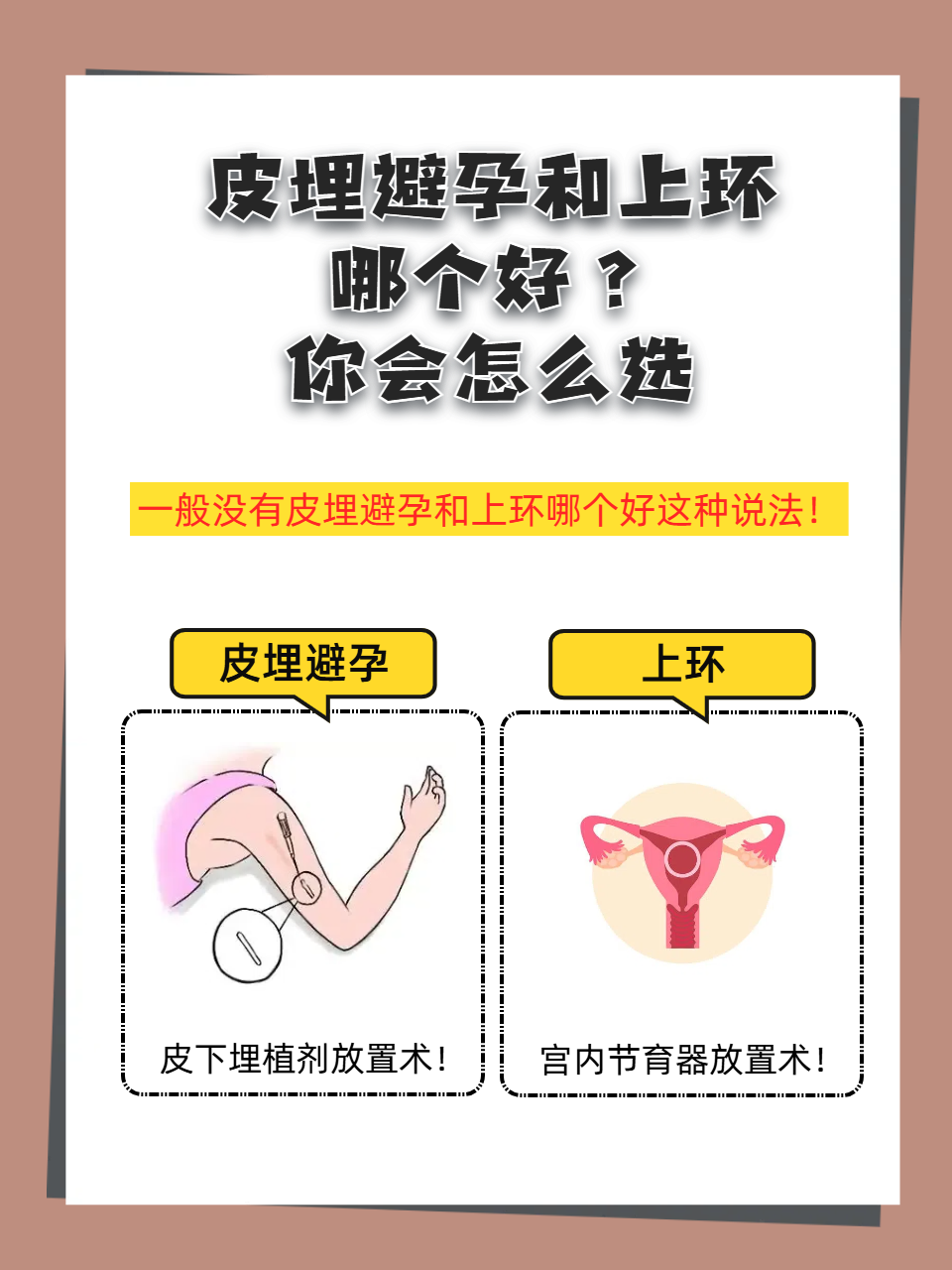 避孕方法有哪些