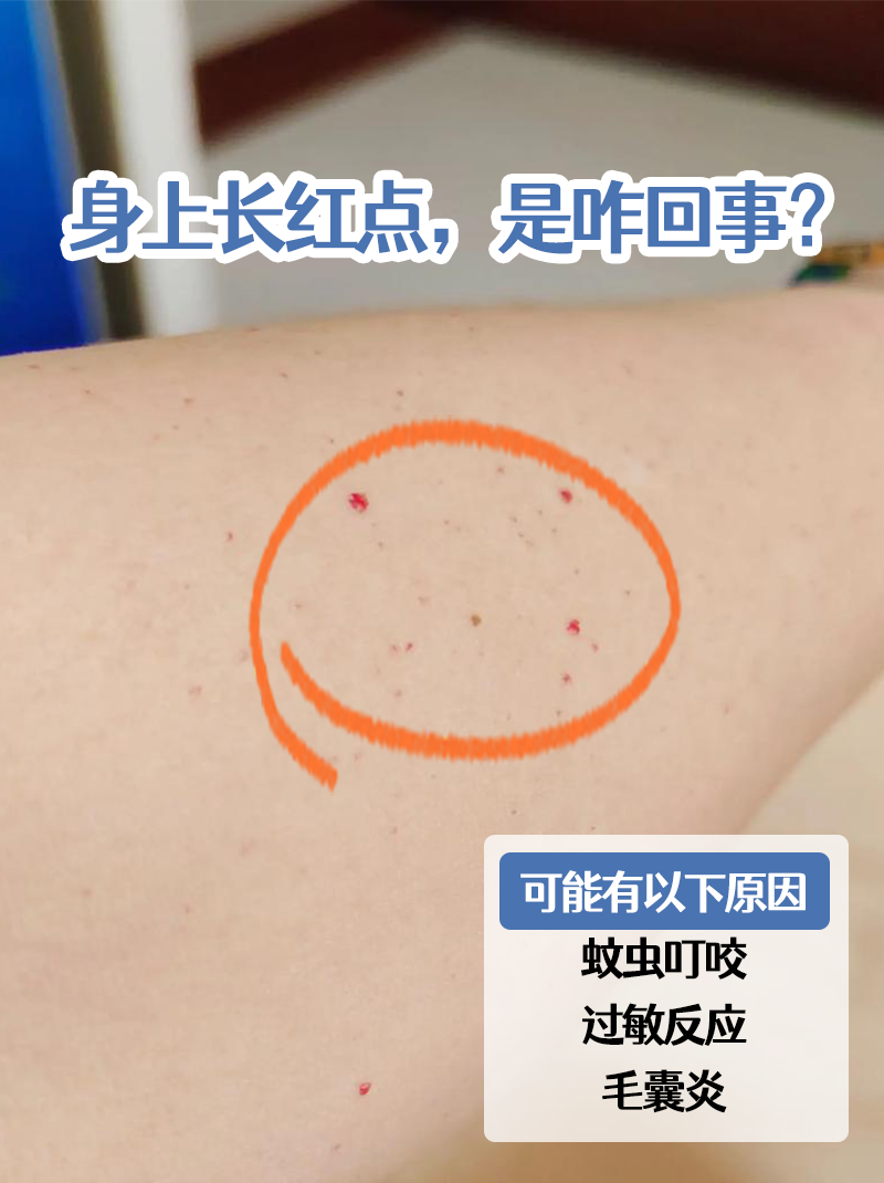身上有小红点是什么病
