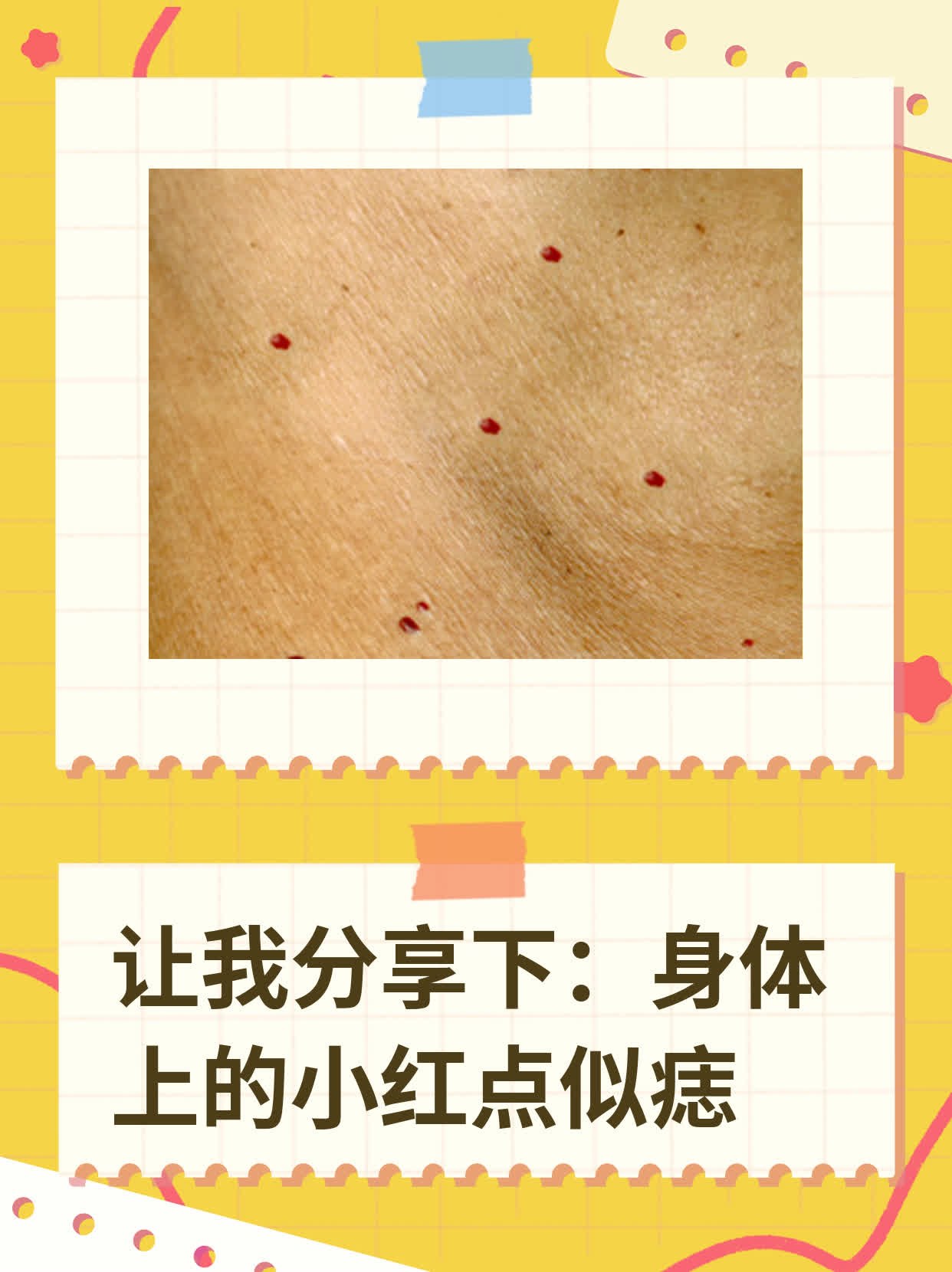 身上有小红点是什么病