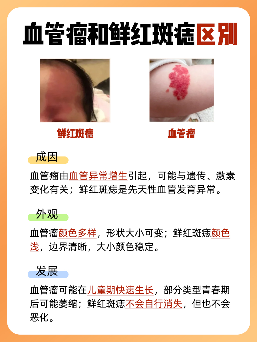 新生儿血管瘤形成原因