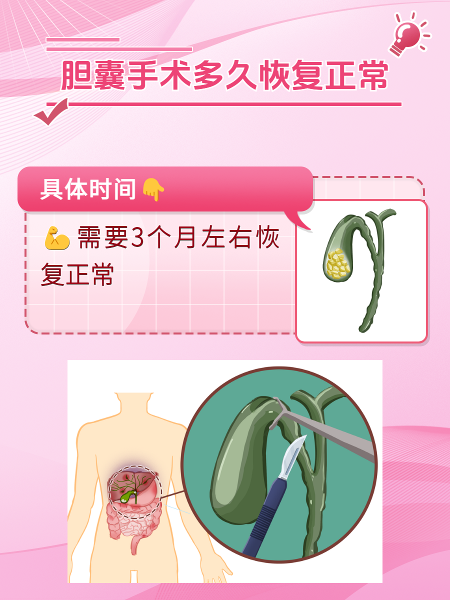 胆结石多大需要手术