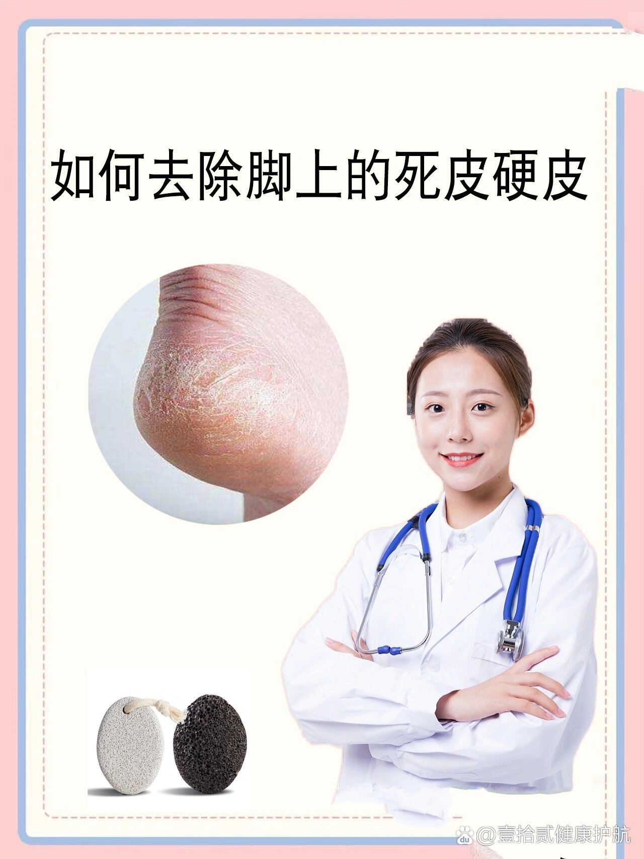 脚上老茧怎么消除