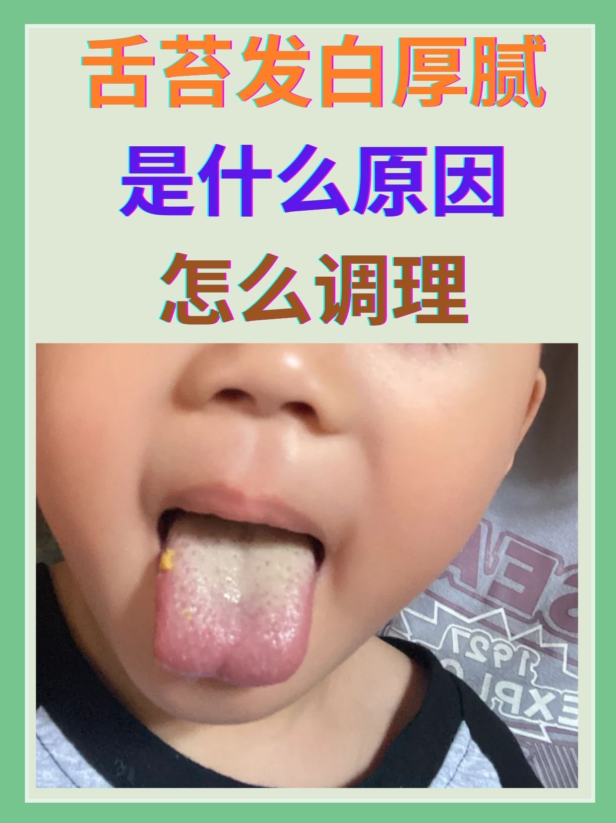 宝宝舌苔发白,是怎么回事?