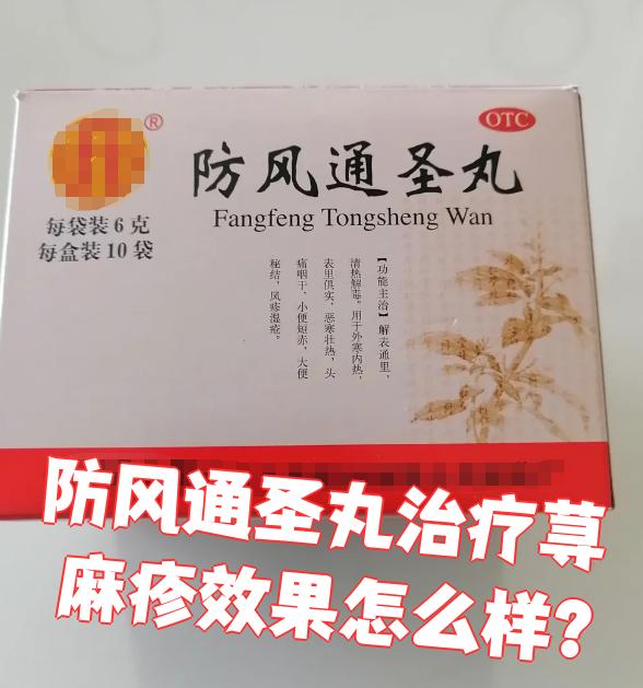 治荨麻疹的药有哪些