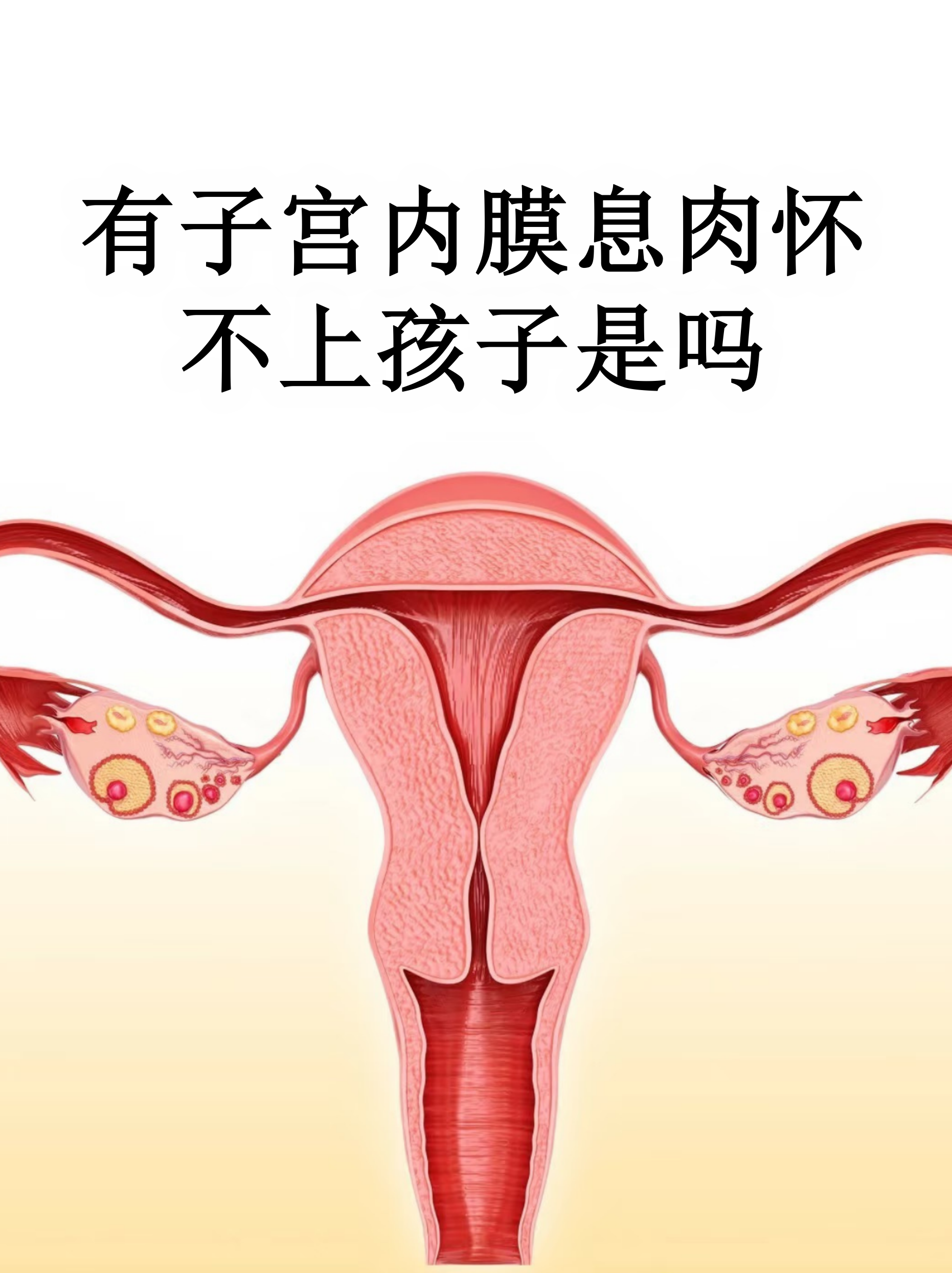 子宫内膜长息肉严重吗