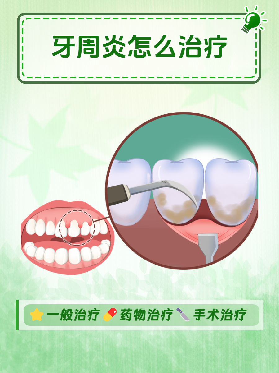 牙周炎的保健方法是什么