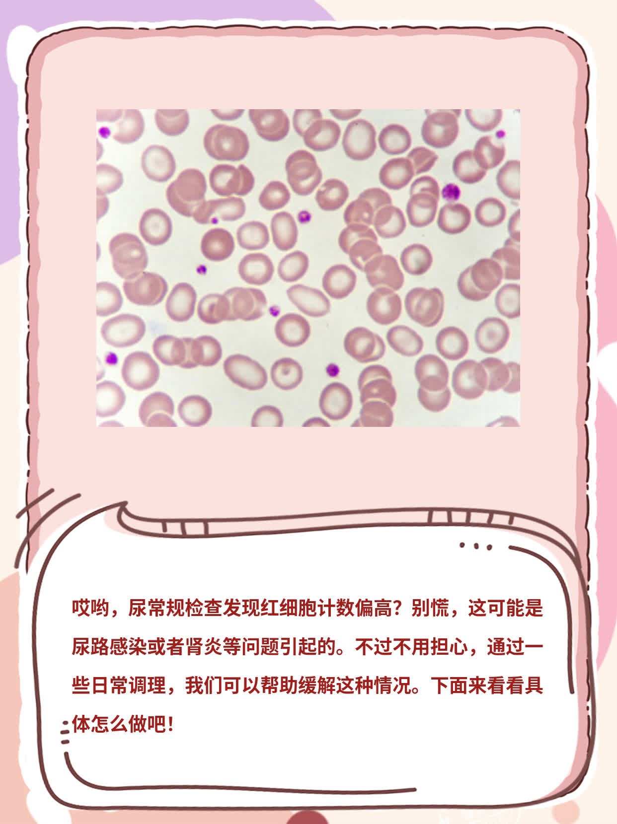 尿检红细胞异常分析