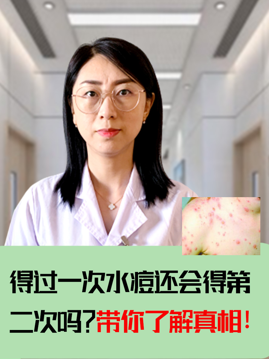 得了水痘大概几天能好