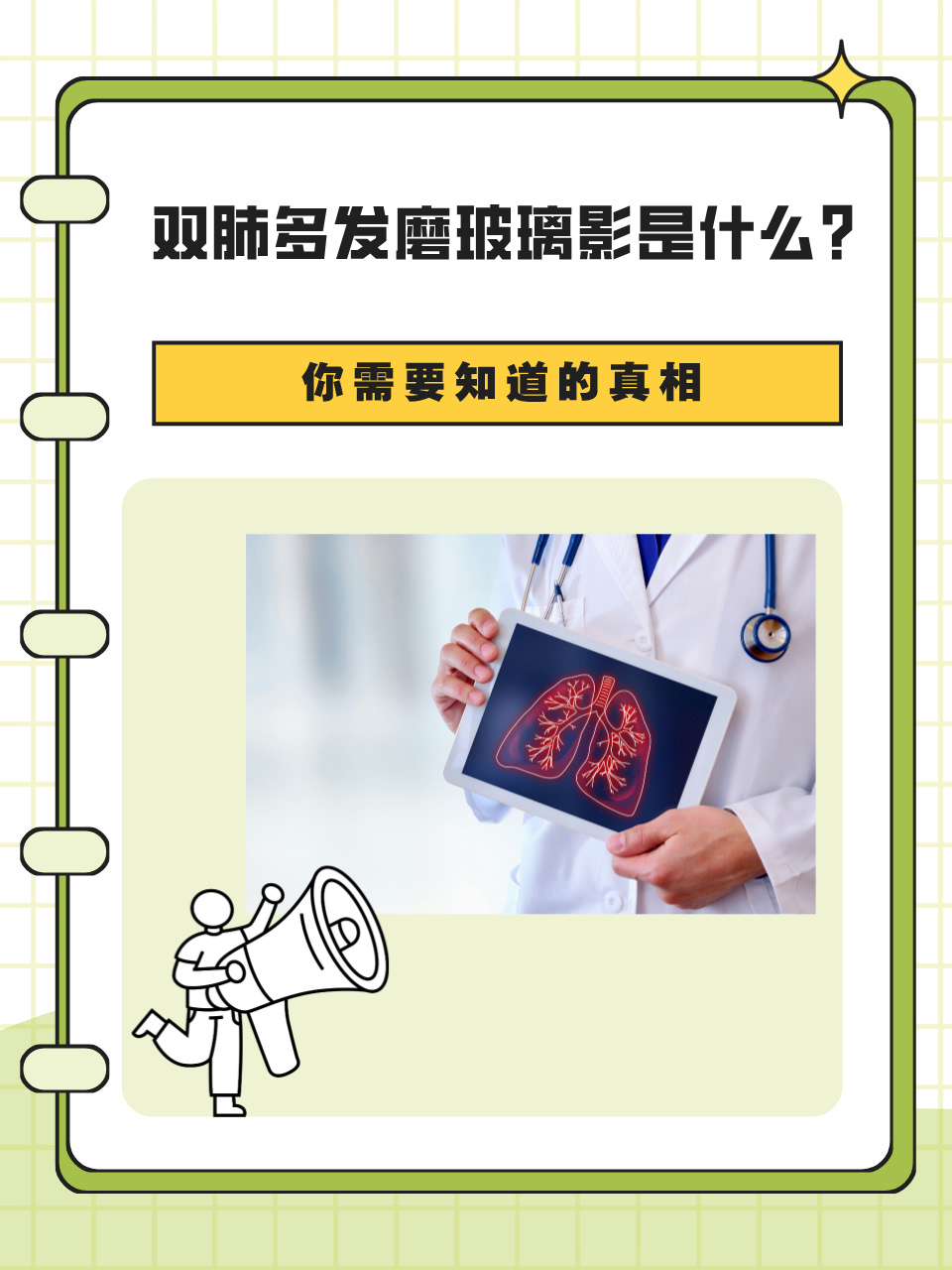 磨玻璃结节与肺癌区别