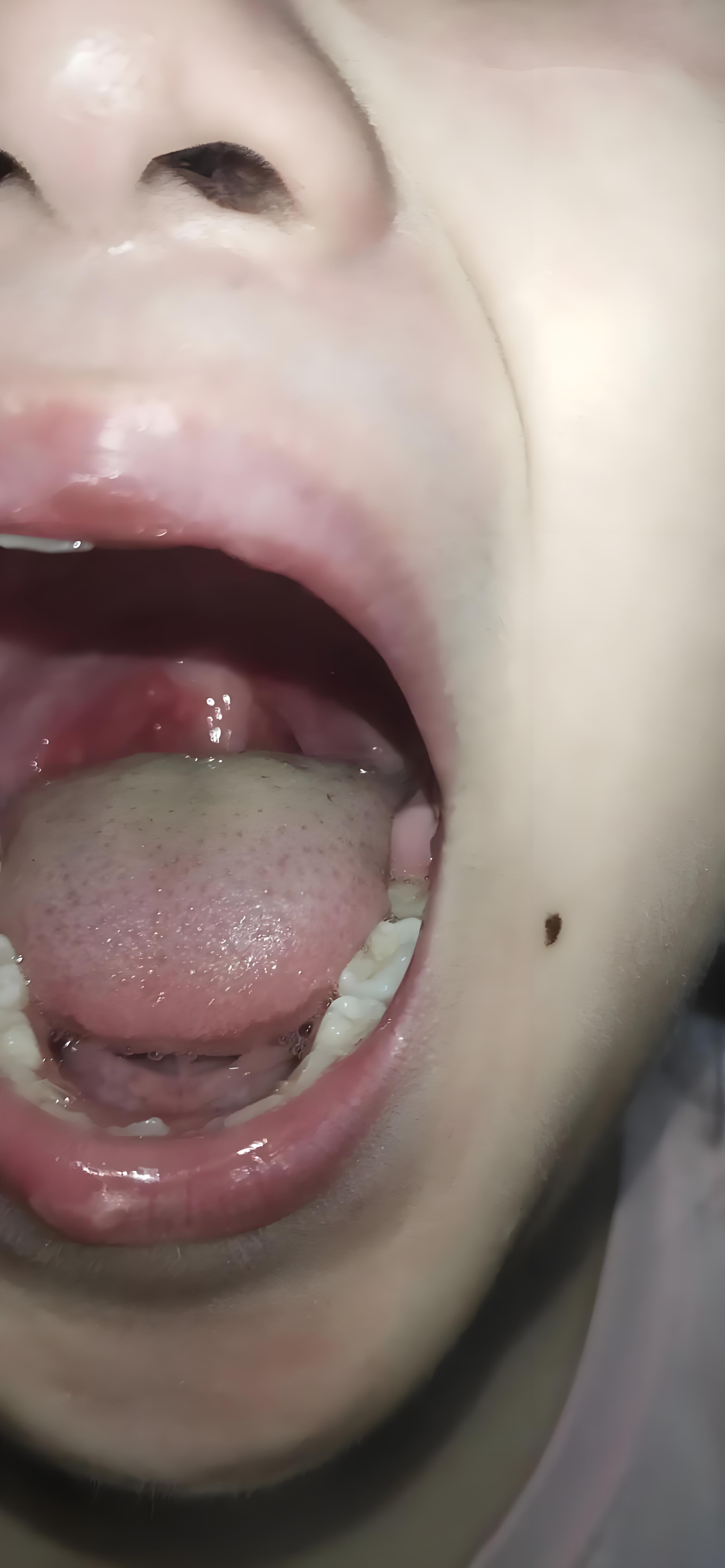 声带损坏会有什么症状?