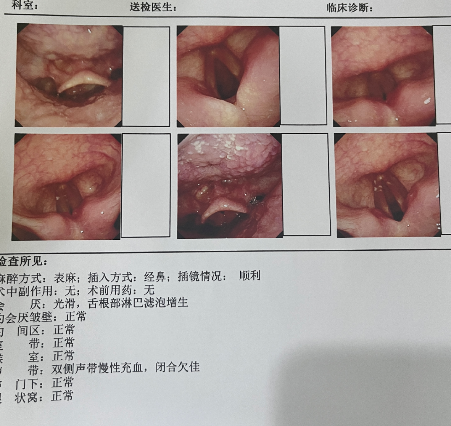 声带损坏会有什么症状?
