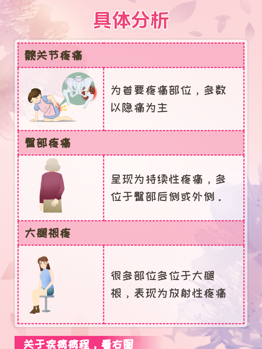 髋关节疼痛的原因有几种