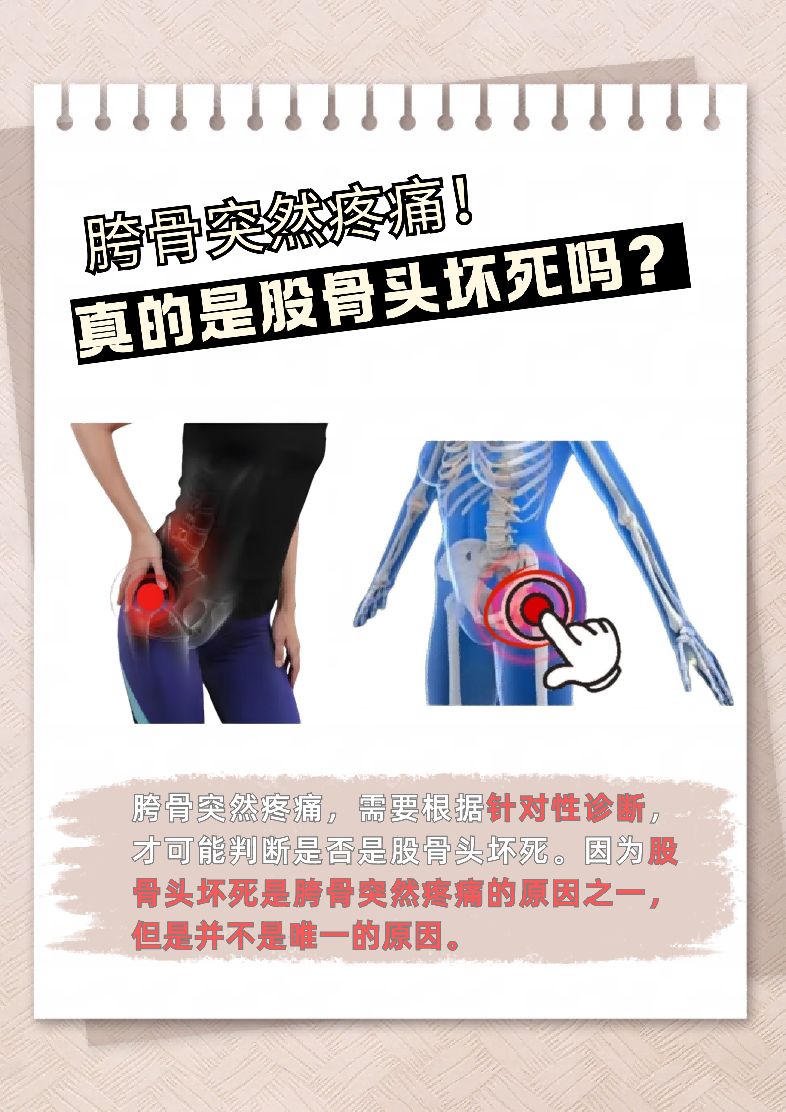 髋关节疼痛的原因有几种