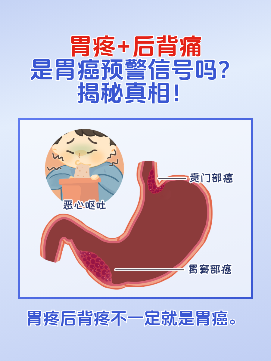 胃泌素瘤是什么原因引起的?