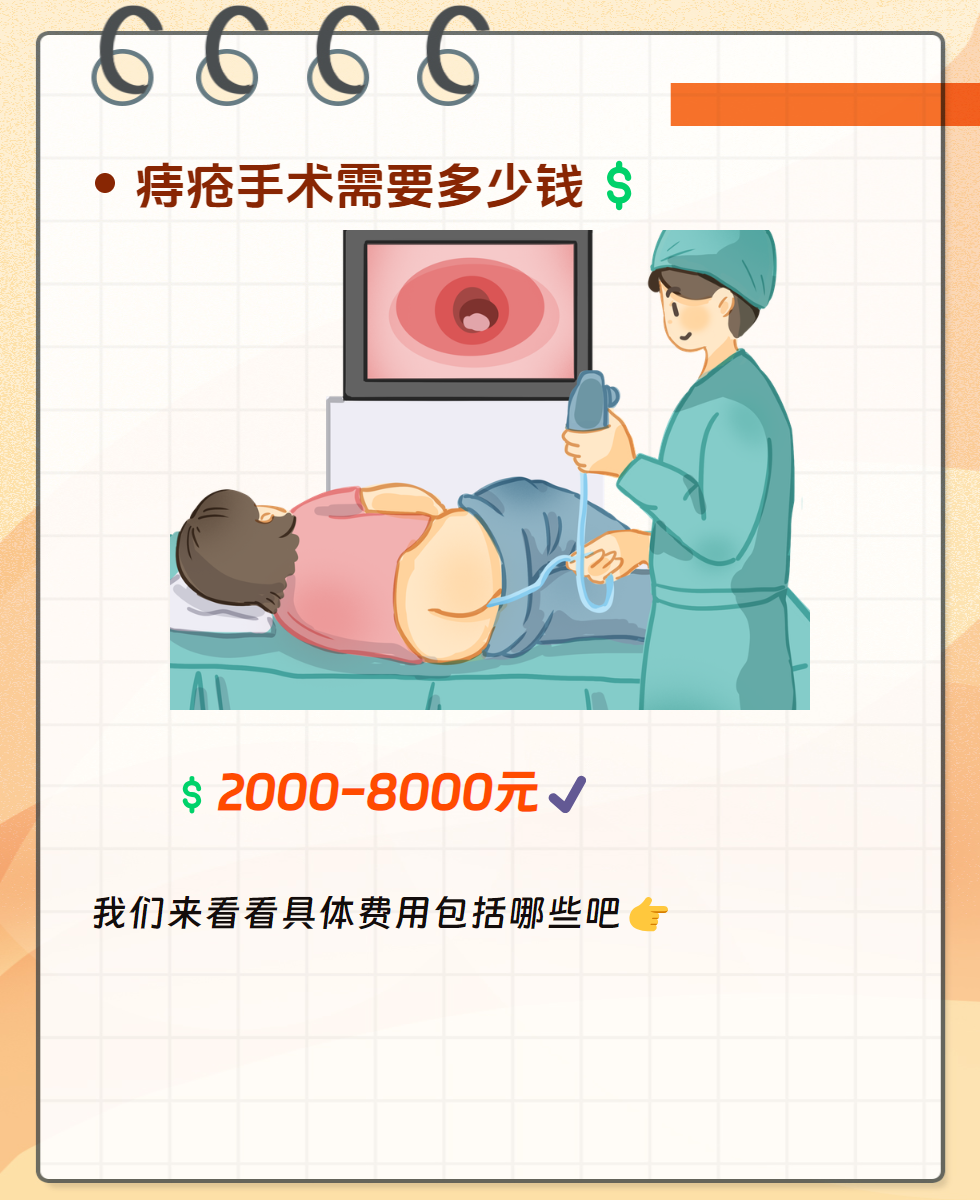 痔疮手术需要住院吗