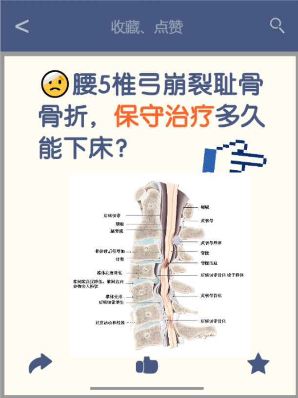 胸腰椎压缩性骨折怎么治疗