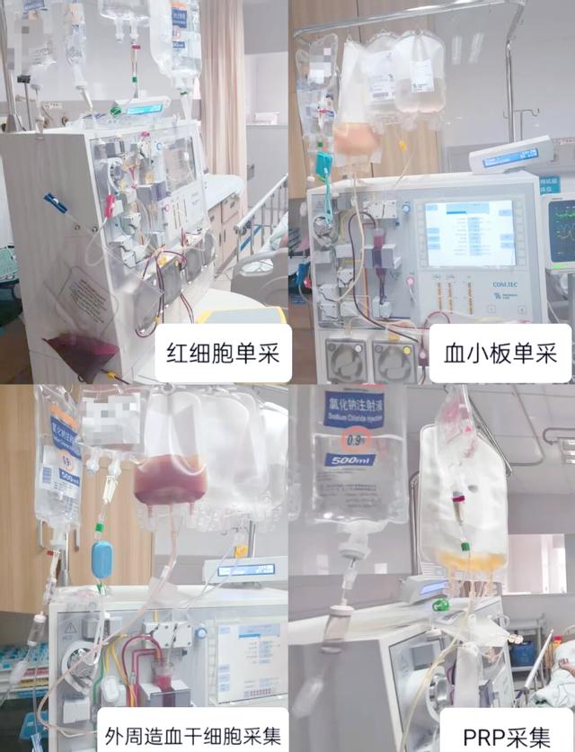 真性红细胞增多症能活多久,