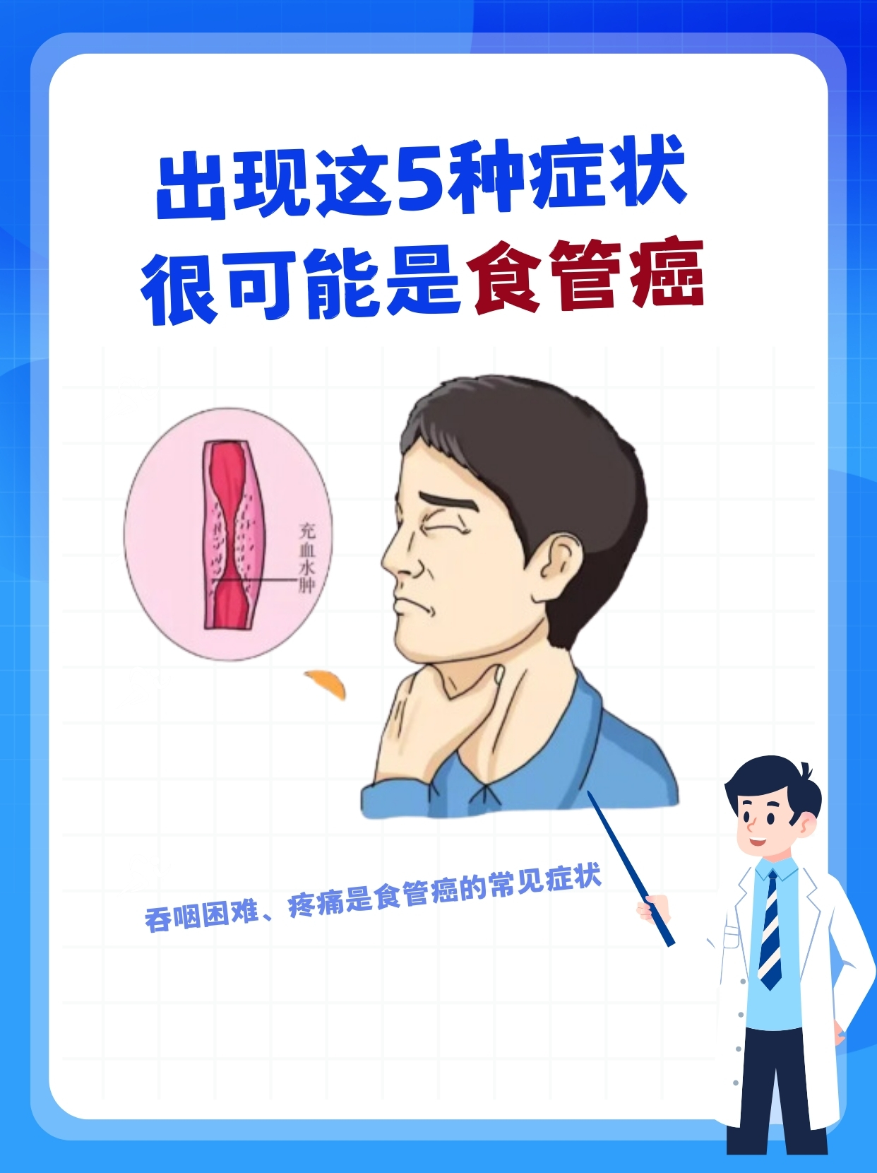 食管癌的病因都有哪些?