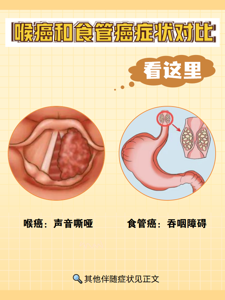 食管癌的病因都有哪些?