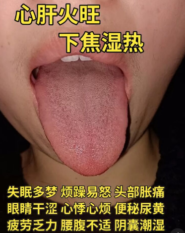 脾虚湿盛的症状有哪些