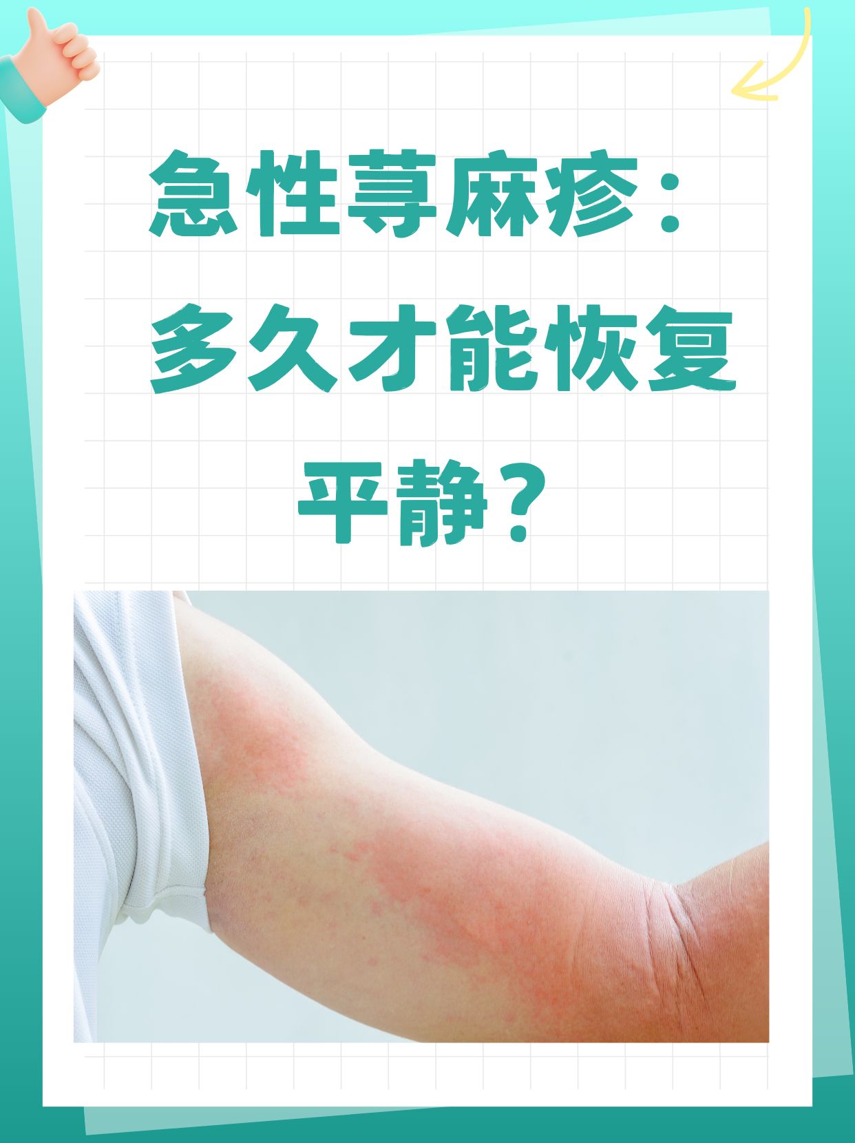 荨麻疹是过敏吗?