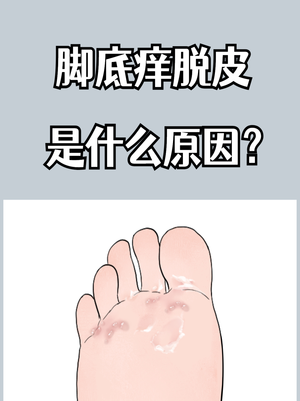 脚底脱皮怎么回事?
