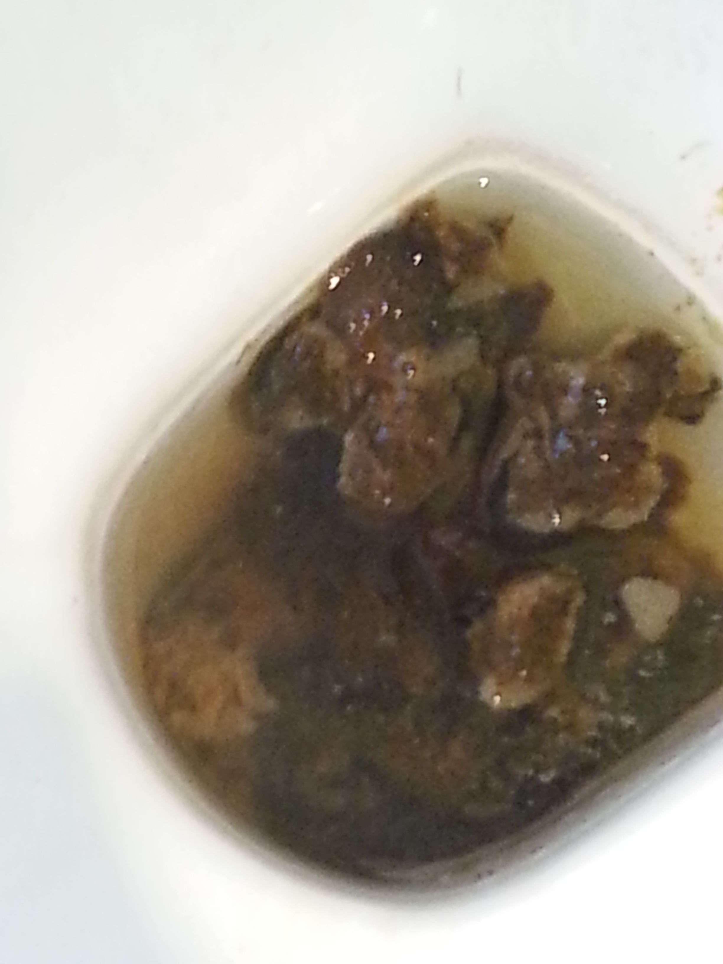 上消化道出血粪便颜色