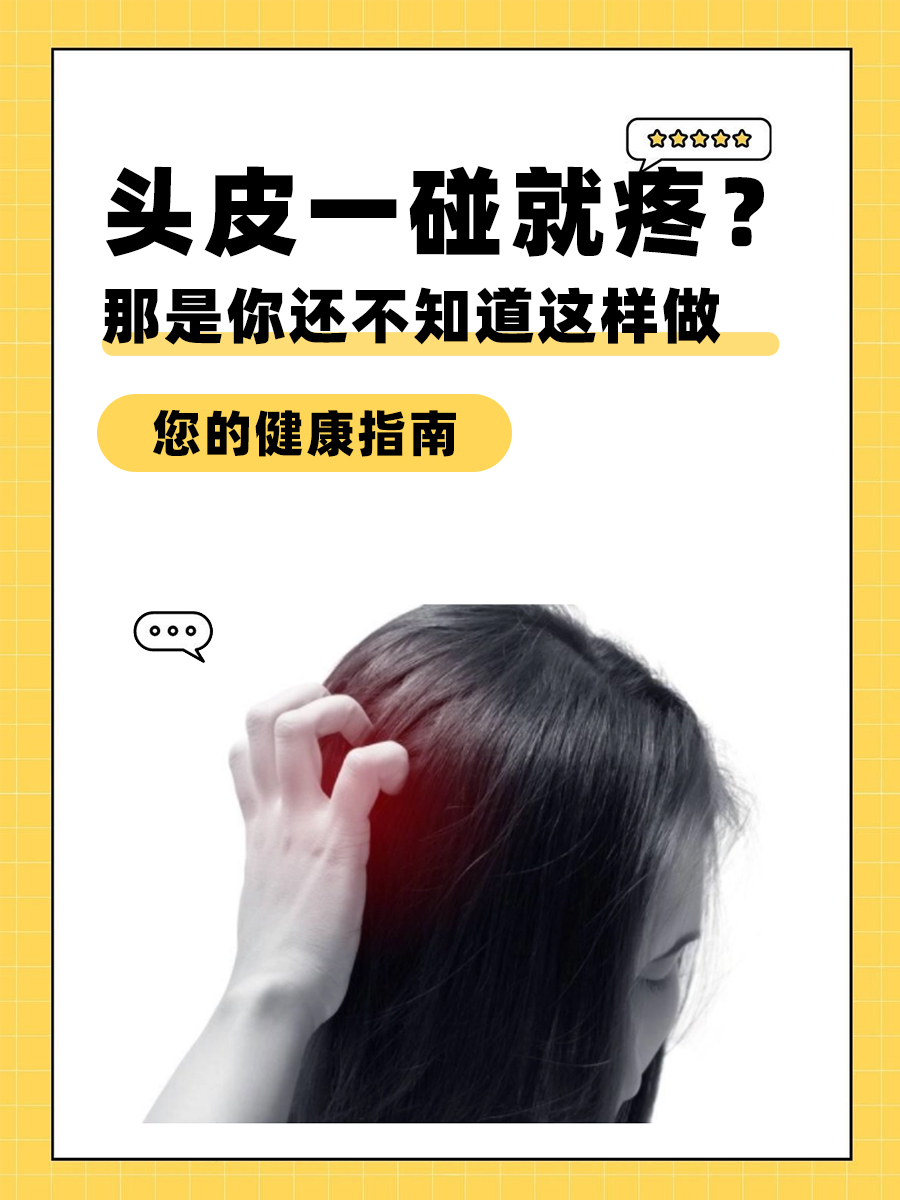 头皮像针扎一样疼怎么办