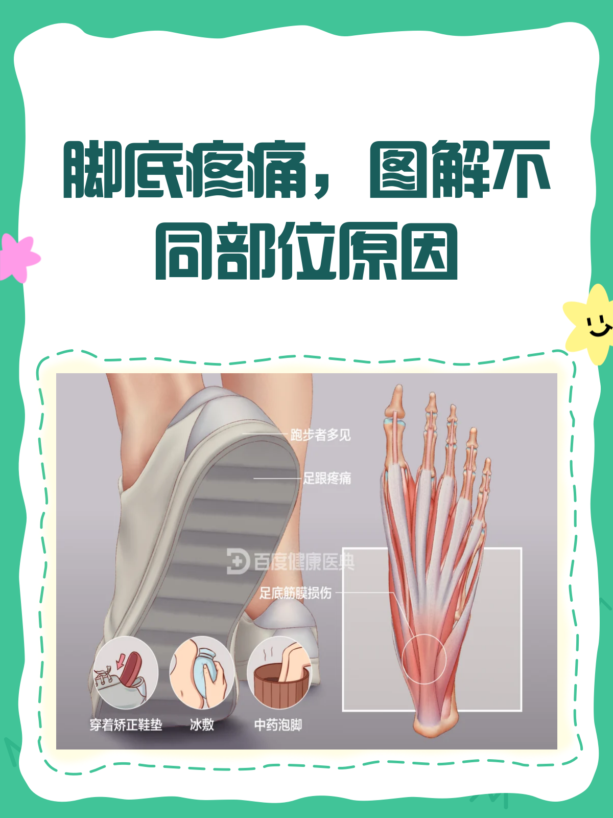 脚心痛,怎么回事?