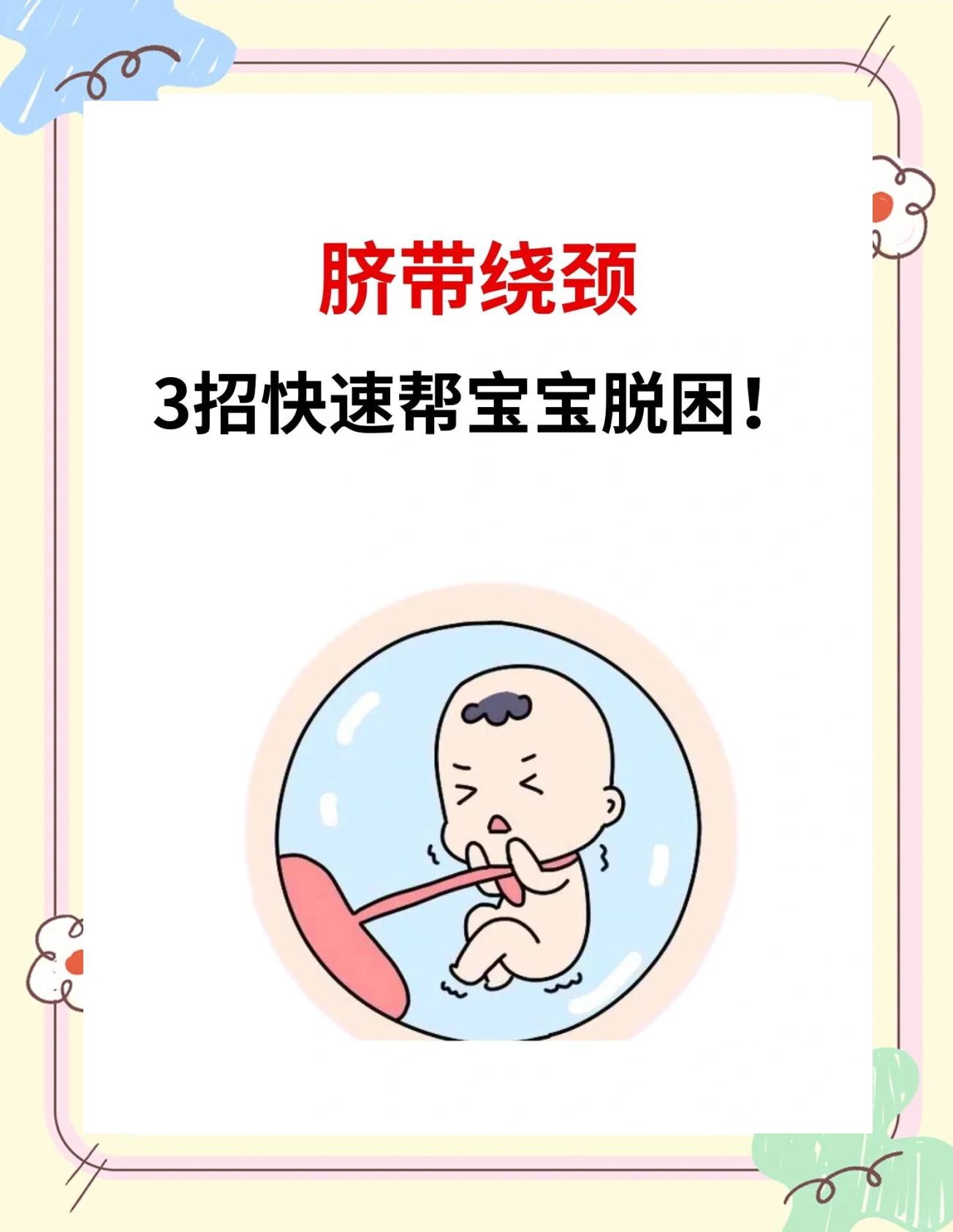 脐带绕颈一周怎么办