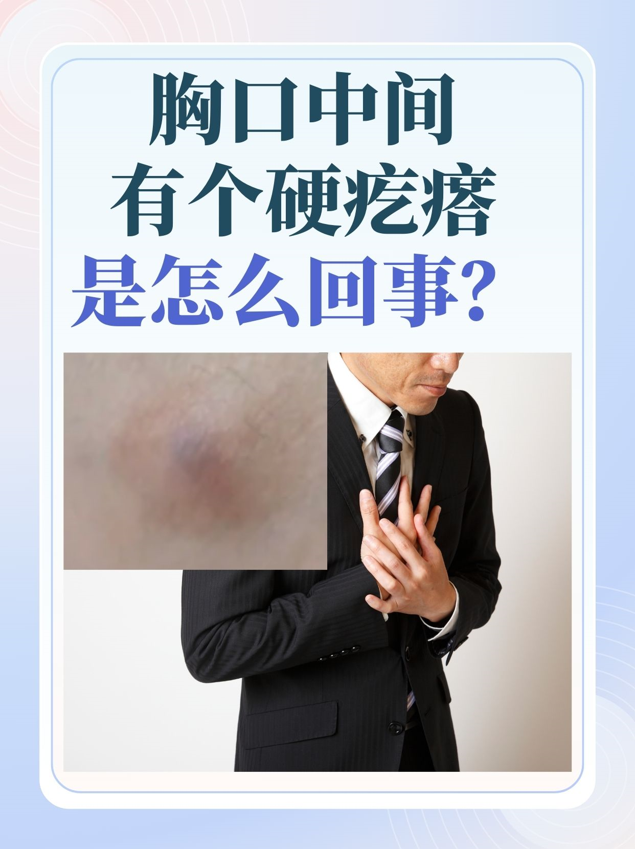 胸部有硬块,很疼是什么