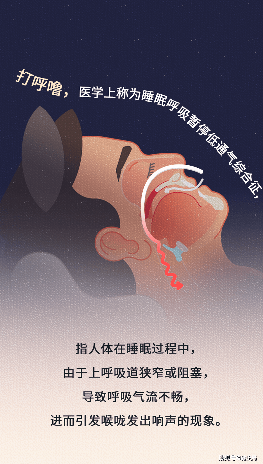 天天晚上打呼噜是病吗