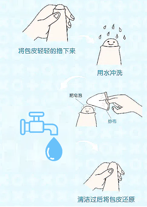 包皮垢怎么清洗才好