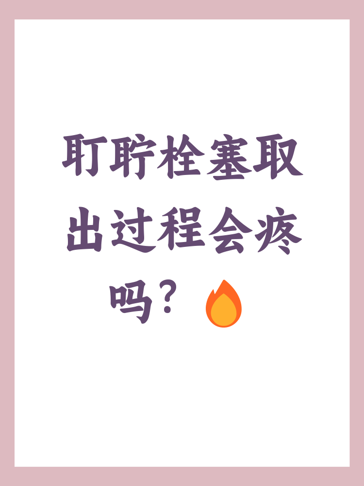 耵聍栓塞自己怎么取出
