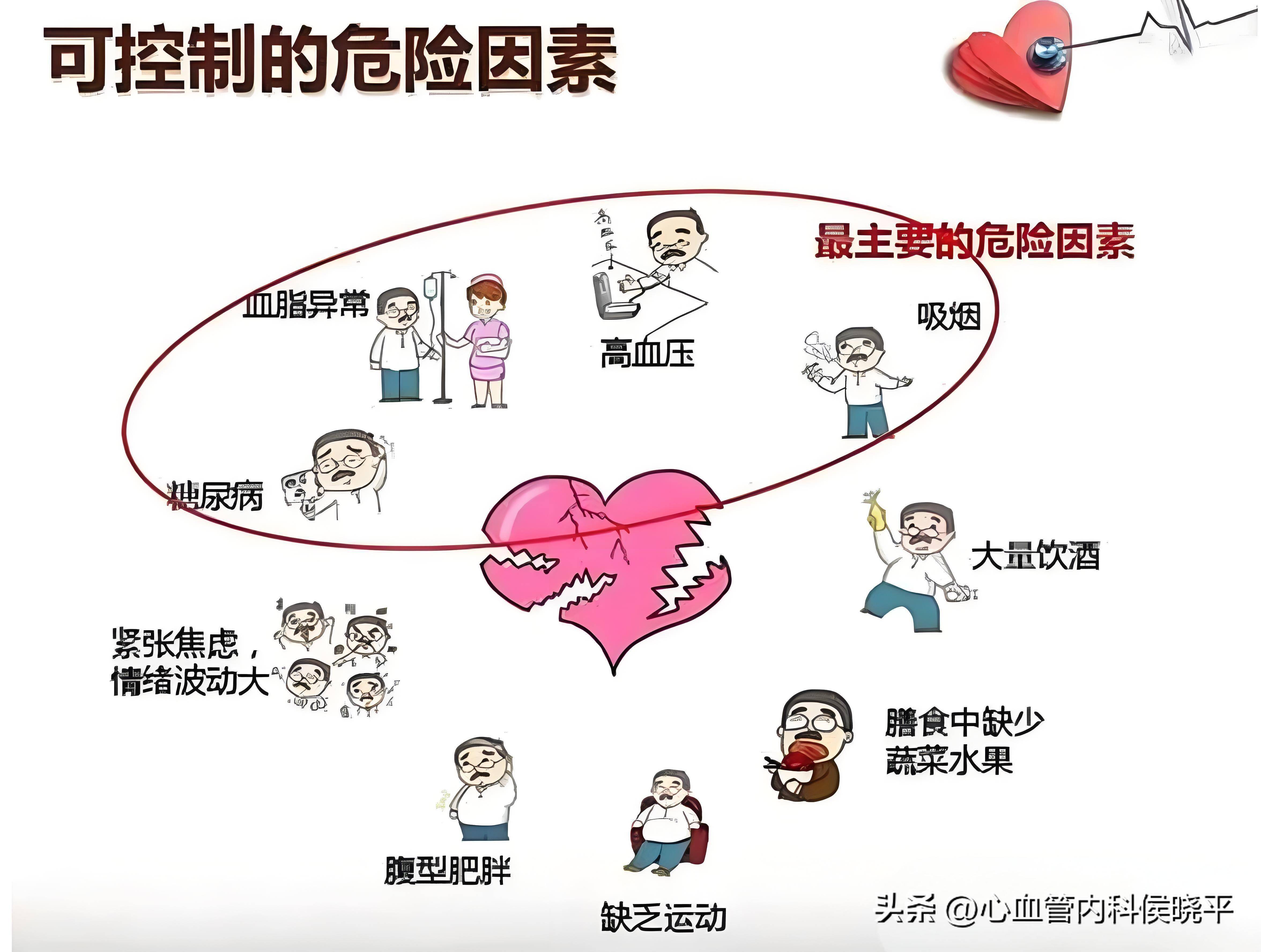 心肌梗塞是由什么原因引起的