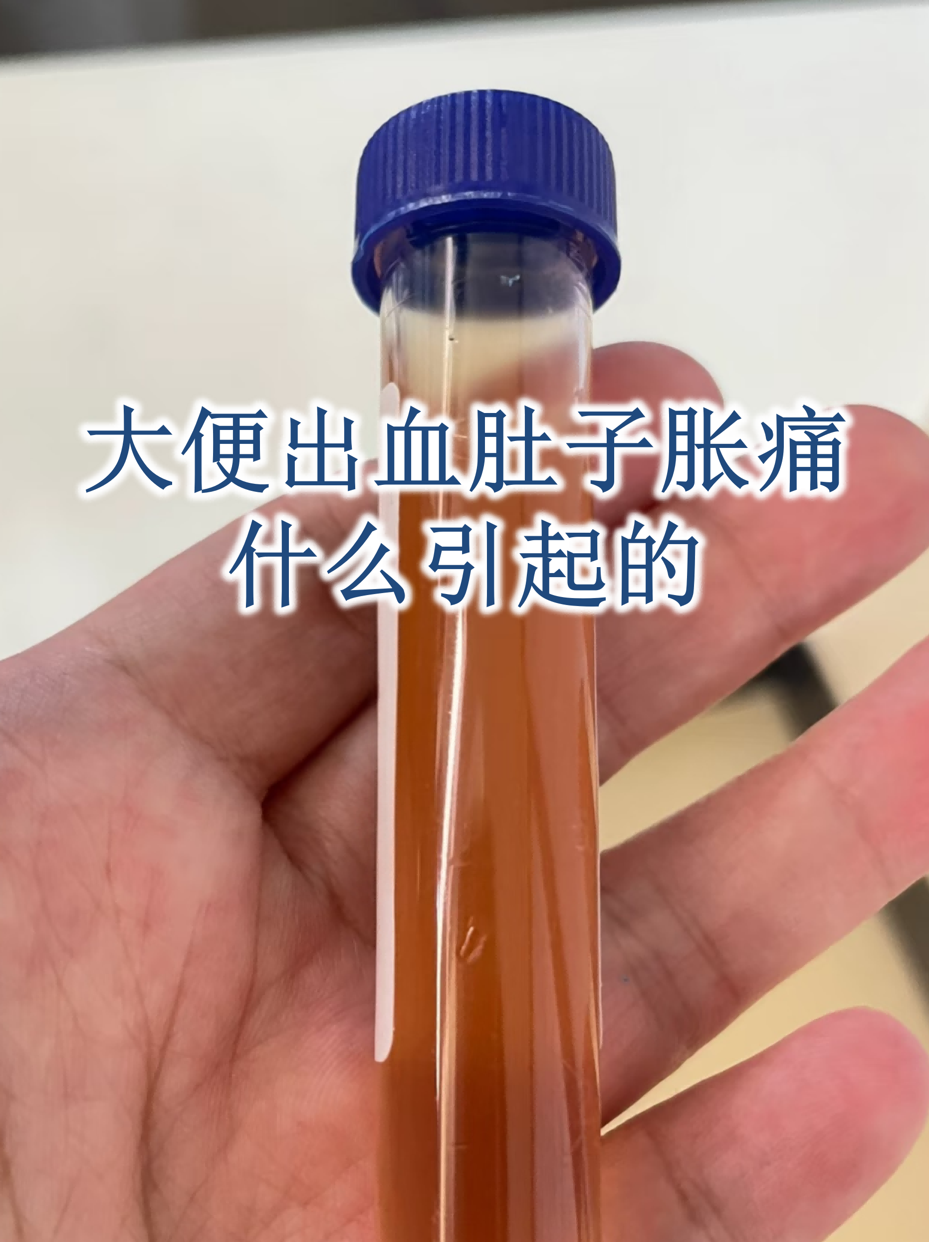 痔疮便血吃什么能好一些