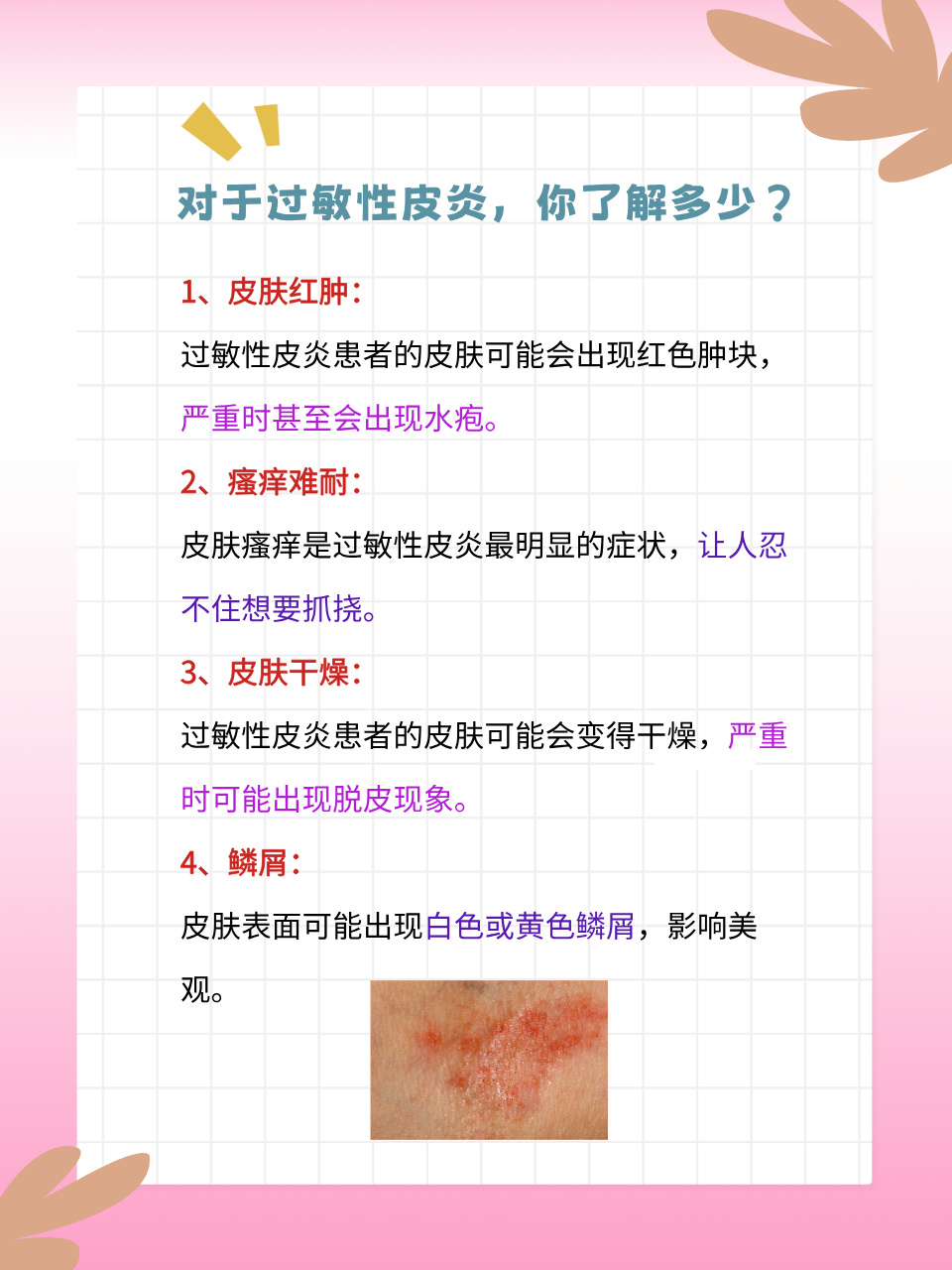 皮肤过敏该如何快速消除