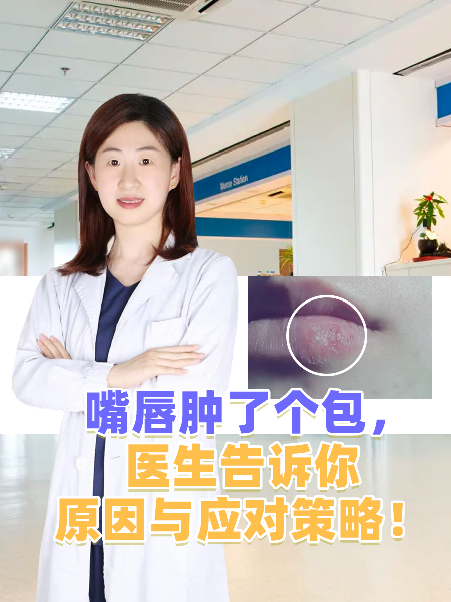 嘴唇为什么突然肿了