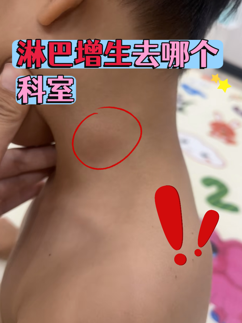 淋巴结肿大五个月不消退