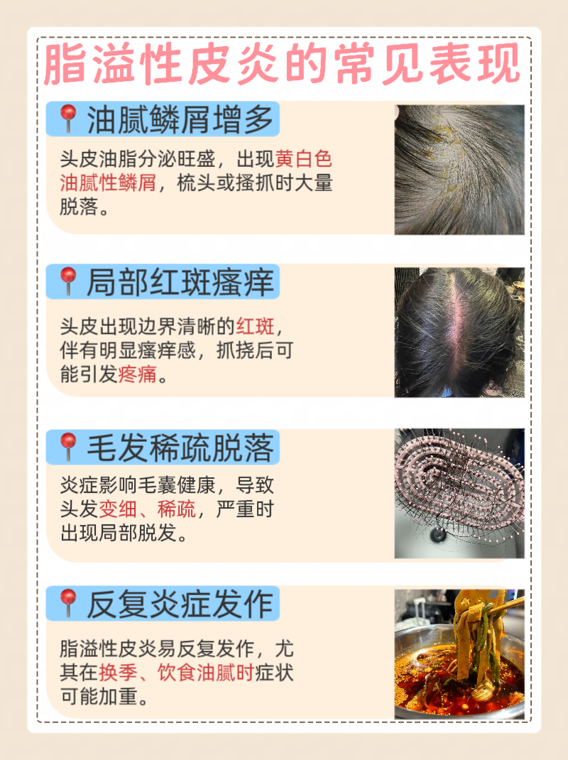 头皮痛是什么原因导致的?