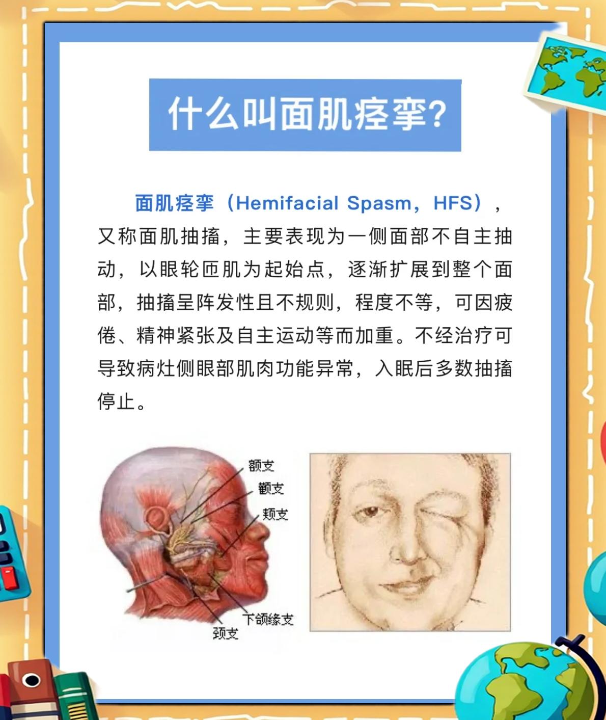 面部肌肉痉挛病因