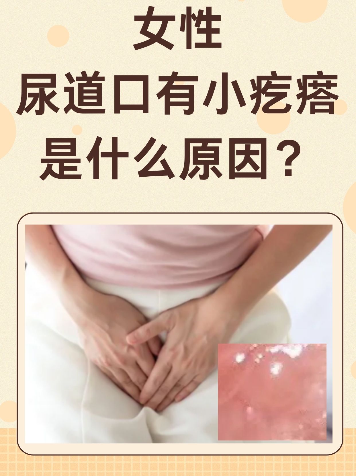 女性泌尿系统感染什么症状