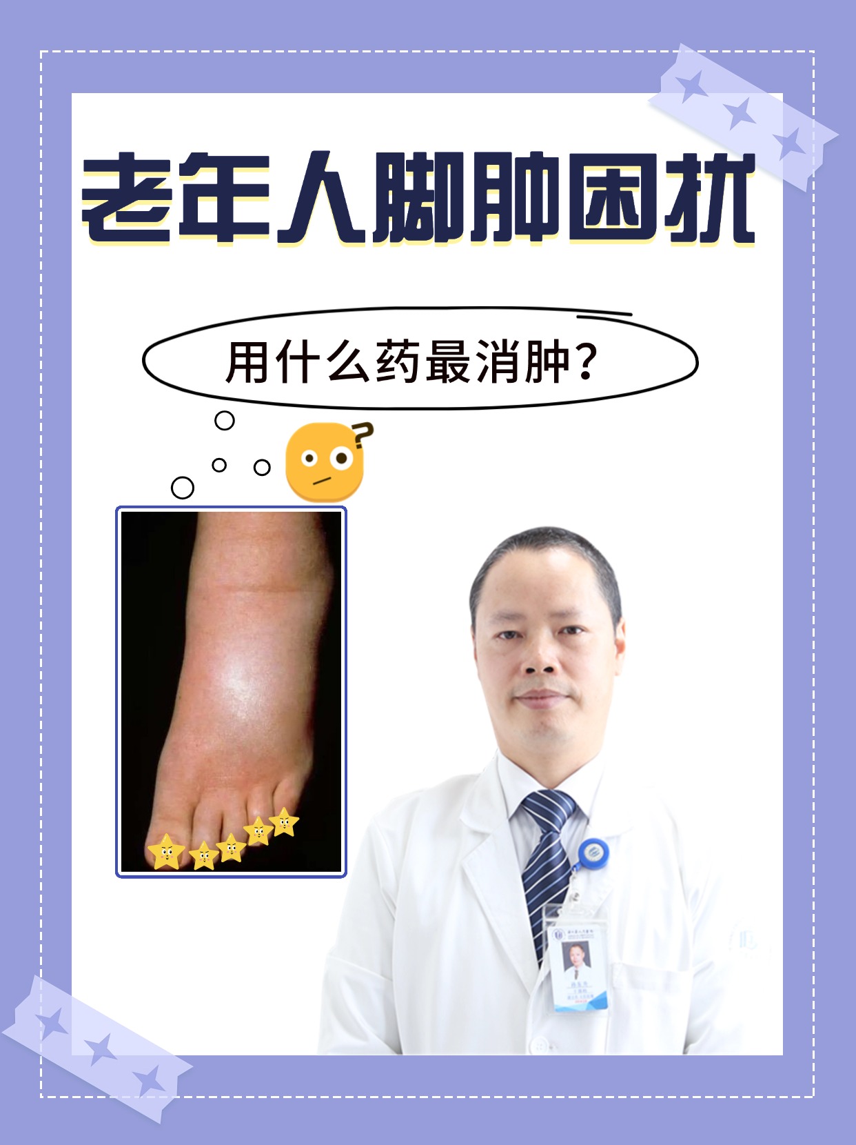 坐久了脚肿,是怎么回事